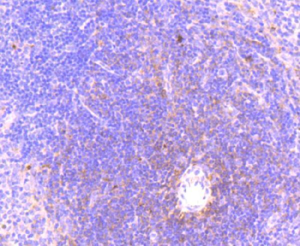 a00535s345 mlkl primary antiboties ihc testing 1
