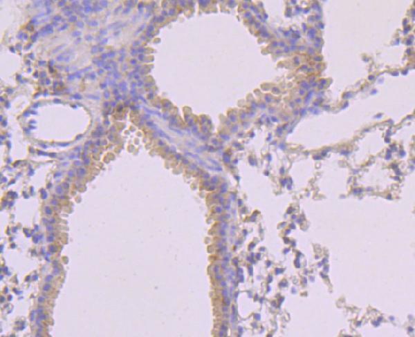 a00535s345 mlkl primary antiboties ihc testing 2
