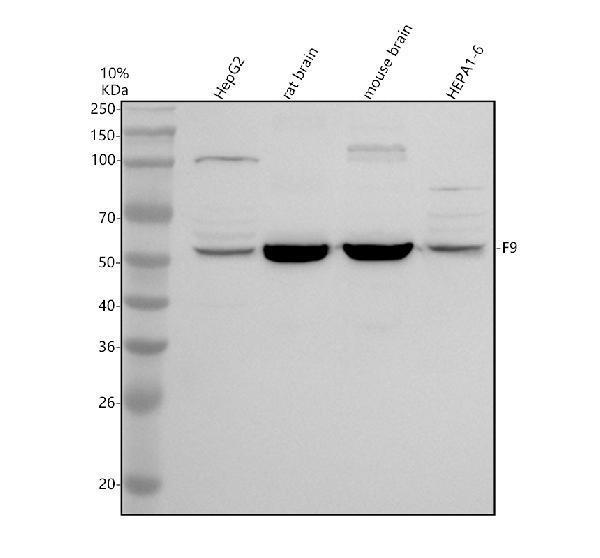 Western blot analysis of Factor IX/PTC/F9 using anti-Factor IX/PTC/F9 antibody (A00537-1)