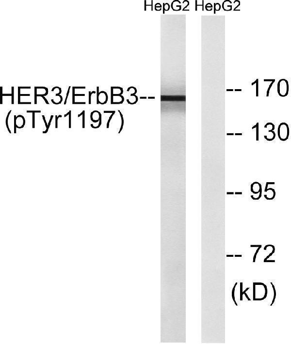 Western blot analysis of lysates from HepG2 cells , using HER3 (Phospho-Tyr1197) Antibody