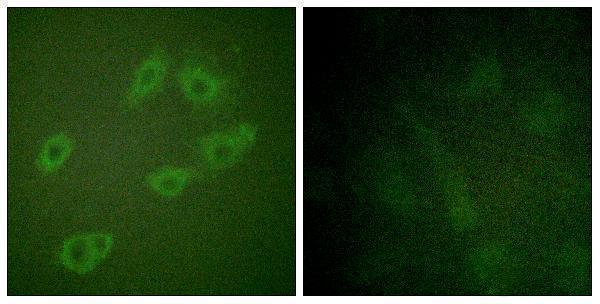 Immunofluorescence analysis of HUVEC cells, using HER3 (Phospho-Tyr1222) Antibody