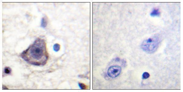 Immunohistochemistry analysis of paraffin-embedded human brain, using HER3 (Phospho-Tyr1222) Antibody