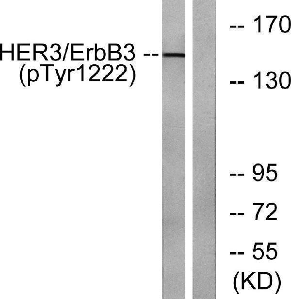 Western blot analysis of lysates from HUVEC cells treated with EGF 200ng/ml 30', using HER3 (Phospho-Tyr1222) Antibody