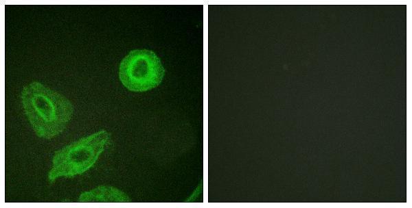 a00539y1289 erbb3 primary antibodies if testing 5