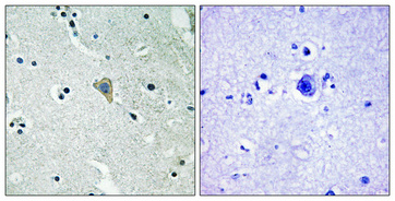 Immunohistochemical analysis of paraffin-embedded Human brain