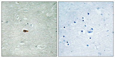 Immunohistochemical analysis of paraffin-embedded Human brain