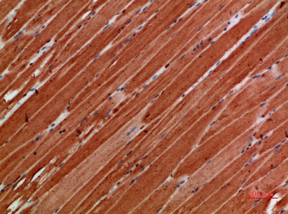 Immunohistochemical analysis of paraffin-embedded human-skeletal-muscle, antibody was diluted at 1:200