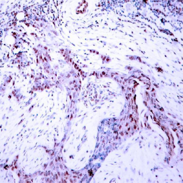 a00541s190 1 pgr primary antibodies ihc testing 1
