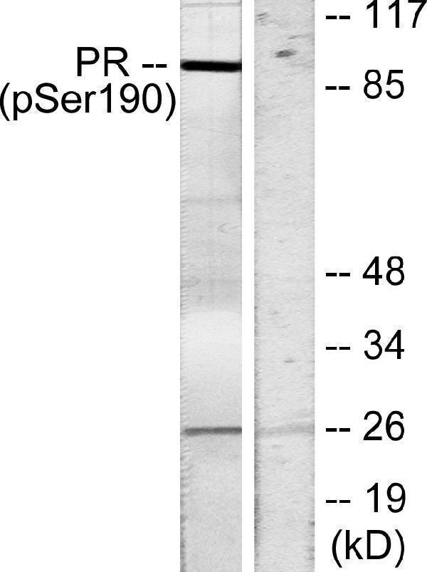 a00541s190 1 pgr primary antibodies wb testing 3