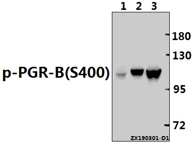 Western blot (WB) analysis of PGR(Phospho-S400) polyclonal antibody at 1:500 dilution
Lane1:The Testis tissue lysate of Mouse(40ug)
Lane2:The Ovary tissue lysate of Rat(40ug)
Lane3:Hela whole cell lysate(30ug)
