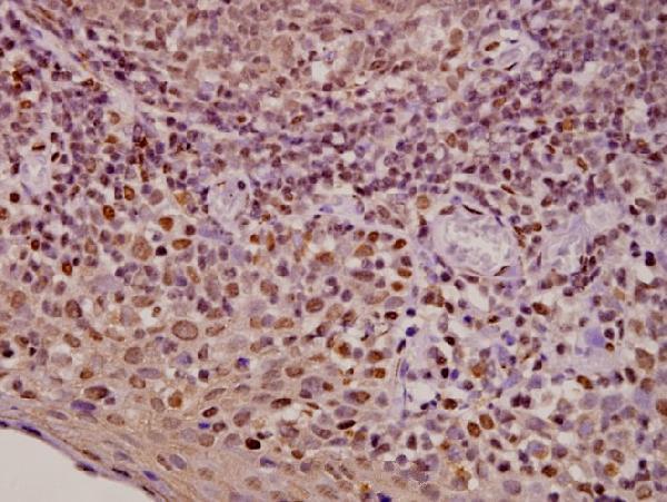 a00542 2 ar primary antiboties ihc testing 2