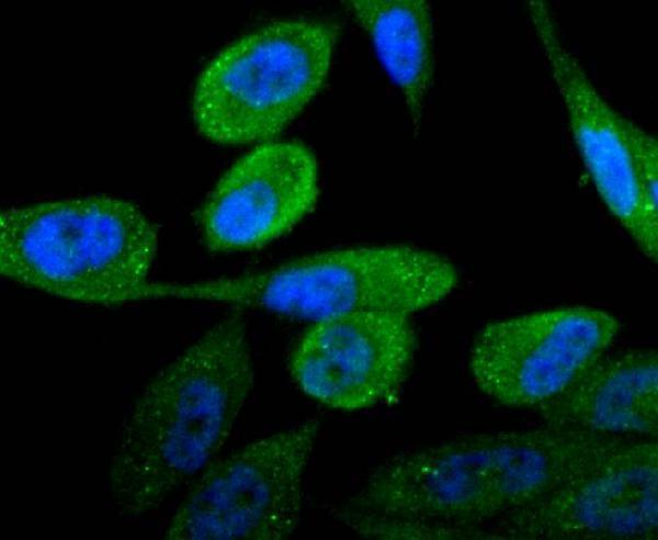 ICC staining Androgen receptor in PC-3M cells (green)
