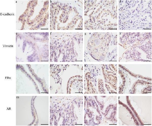 Immunohistochemical analysis of dorsolateral prostate E-cadherin, Vimtein, ERα and AR expression in aged rats