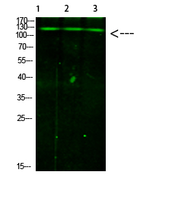 Western blotting validation for Anti-Phospho-JAK2/3 (Tyr966/939) AR Antibody A00542Y966
Western Blot analysis of 1