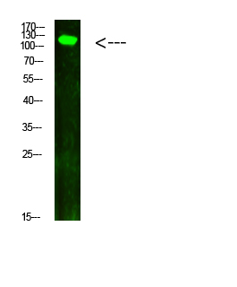 Western blotting validation for Anti-Phospho-JAK2/3 (Tyr966/939) AR Antibody A00542Y966
Western Blot analysis of hela cells using primary antibody diluted at 1:1000 (4°C overnight)