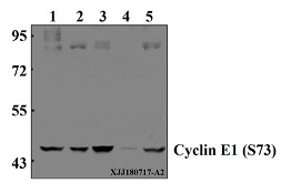 Western blot (WB) analysis of Cyclin E1 (S73) pAb at 1:500 dilution
Lane1:HEK293T whole cell lysate(40µg)
Lane2:MCF-7 whole cell lysate(40µg)
Lane3:Myla2059 whole cell lysate(40µg)
Lane4:The testis tissue lysate of Rat(40µg)
Lane5:CT-26 whole cell lysate(40µg)