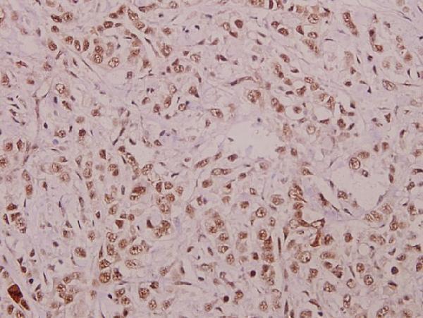 a00543t395 ccne1 primary antiboties ihc testing 2