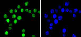 ICC staining Phospho-Cyclin E1(T77) in SW480 cells (green)