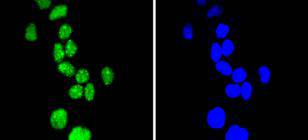 ICC staining Phospho-Cyclin E1(T77) in Hela cells (green)