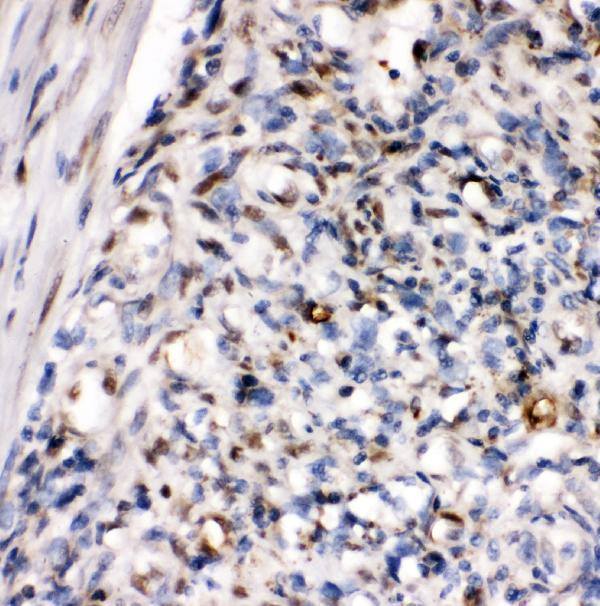 a00548 2 zeb1 primary antibodies ihc testing 3