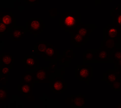 Immunofluorescence of ZEB1 in Hela cells with ZEB1 antibody at 20 μg/mL
