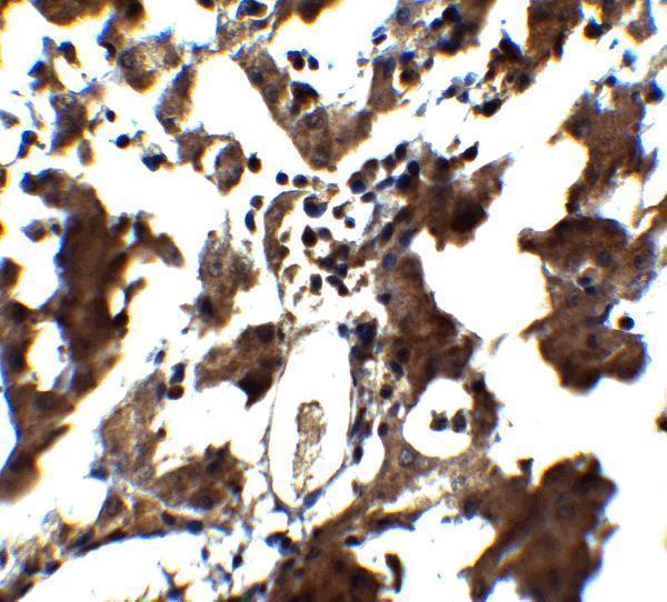 Immunohistochemistry of ZEB1 in human liver tissue with ZEB1 antibody at 5 μg/mL