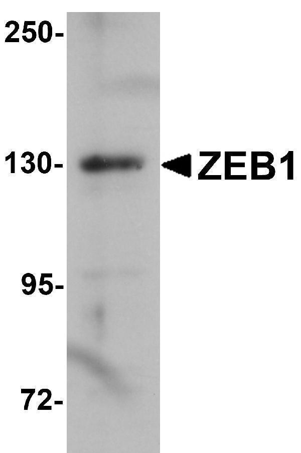 Western blot analysis of ZEB1 in HeLa cell lysate with ZEB1 antibody at 1μg/mL