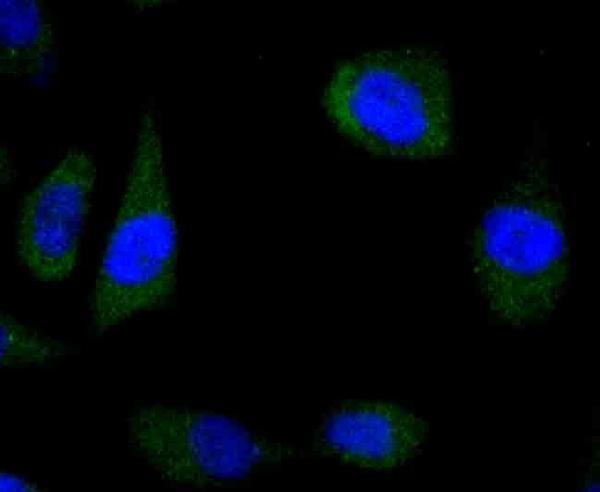 ICC staining Wnt5a in PC-3M cells (green)