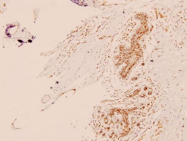 a00550 1 med1 primary antiboties ihc testing 2
