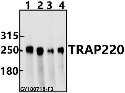 a00550 1 med1 primary antiboties wb testing 1