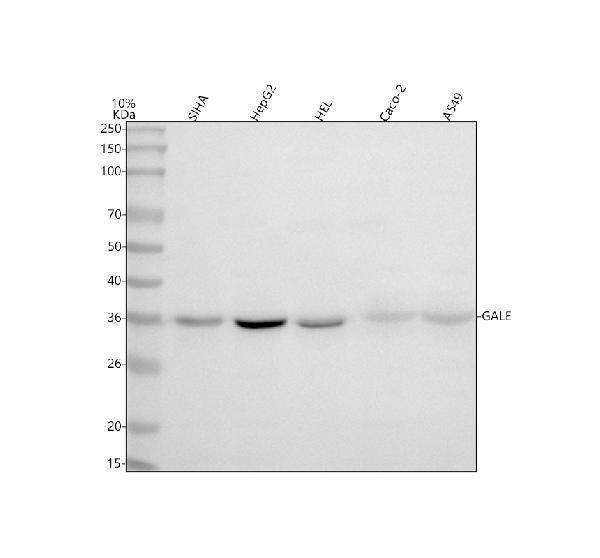  Western blot analysis of GALE using anti-GALE antibody (A00551-1)