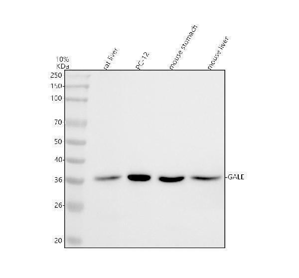  Western blot analysis of GALE using anti-GALE antibody (A00551-1)