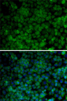 a00552 1 cdk7 primary antiboties if testing 4