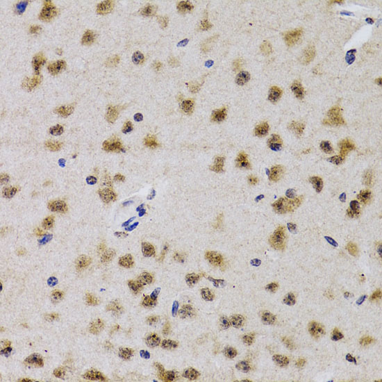 a00552 1 cdk7 primary antiboties ihc testing 2