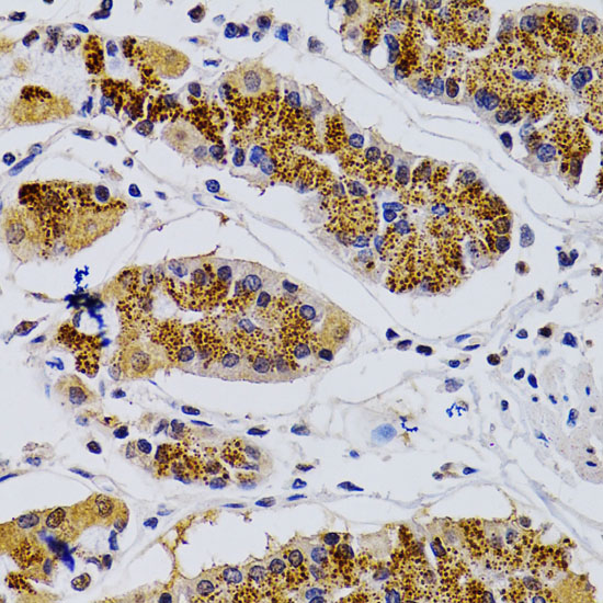 a00552 1 cdk7 primary antiboties ihc testing 3