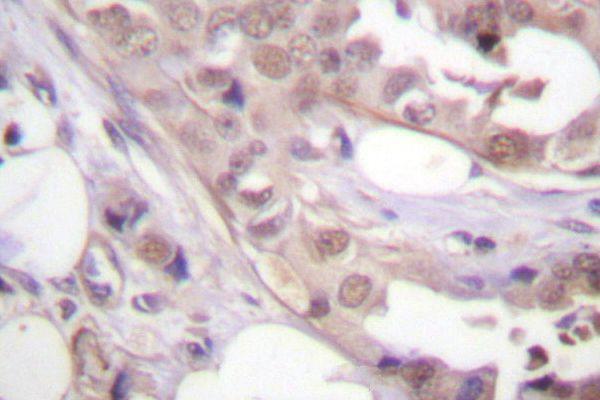 a00552 cdk7 primary antiboties ihc testing 2
