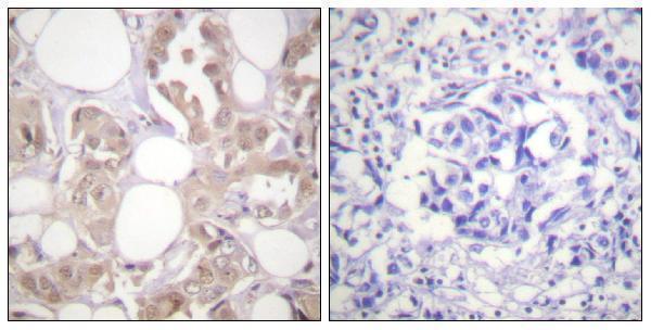 a00552t170 cdk7 primary antibodies ihc testing 1