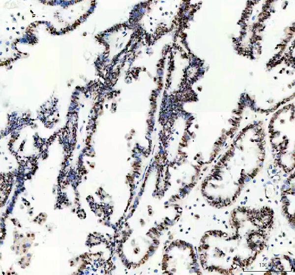  IHC analysis of MSH6 using anti-MSH6 antibody (A00553-2)