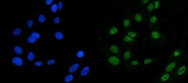  IF analysis of MSH6 using anti-MSH6 antibody (A00553-3)