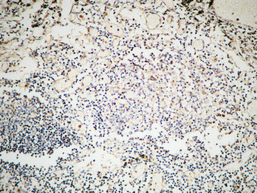 a00553 msh6 primary antibodies ihc testing 1