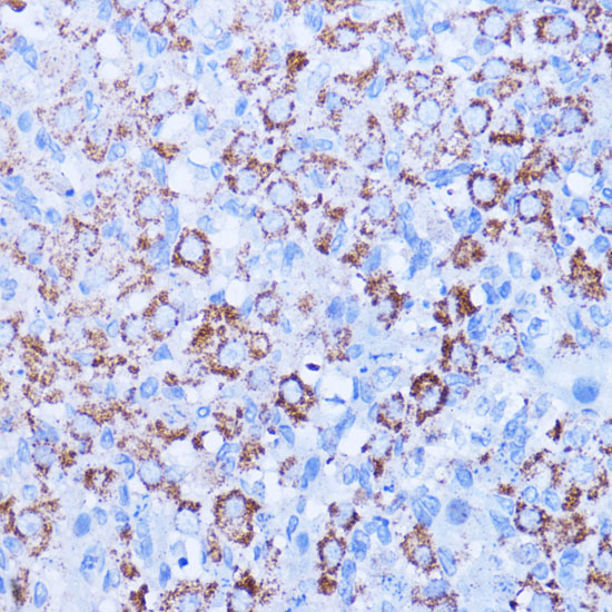 Immunohistochemistry of paraffin-embedded rat ovary using ISG15 antibody  at dilution of 1:100 