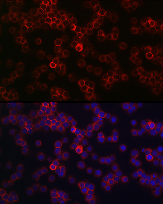 a00555 1 ptprc primary antiboties if testing 4