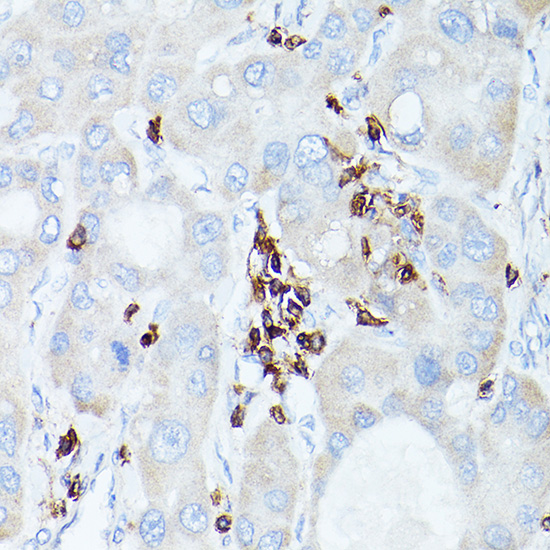 a00555 1 ptprc primary antiboties ihc testing 3