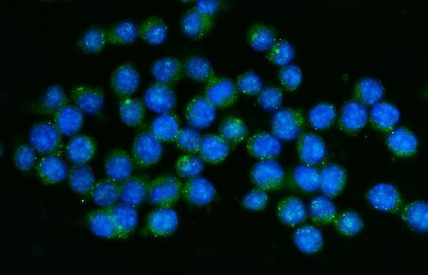 a00555 4 ptprc primary antibodies if testing 5