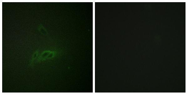 Immunofluorescence analysis of HeLa cells, using CD45 (Phospho-Ser1007) Antibody