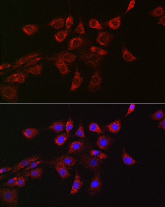 a00556 1 dnm1l primary antiboties if testing 3