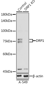 a00556 1 dnm1l primary antiboties wb testing 1