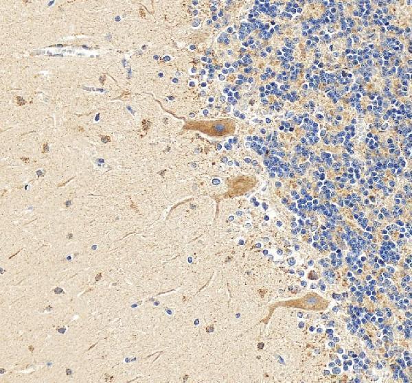 IHC analysis of DRP1/DNM1L using anti-DRP1/DNM1L antibody (A00556-2)