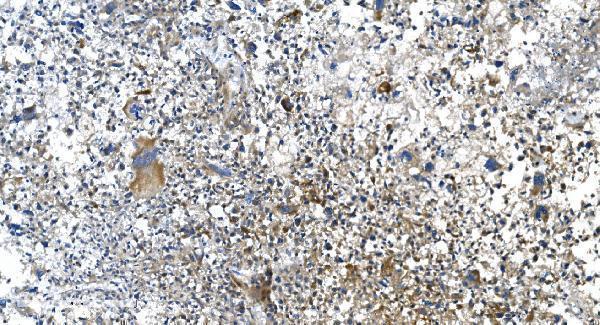 a00556 2 dnm1l primary antibodies ihc testing 2