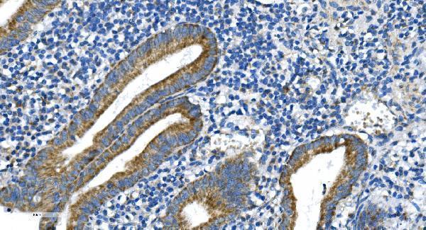 a00556 2 dnm1l primary antibodies ihc testing 3